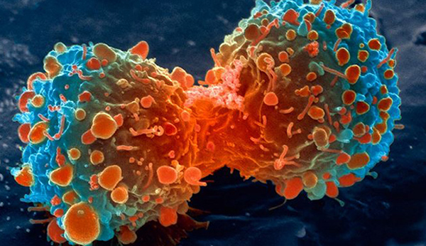 Ung thư di căn theo hệ thống bạch huyết và máu